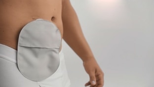 Appliance guide for stoma bag