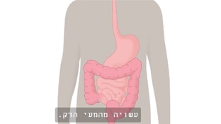 לולאת אילאוסטומי, הסרת רקטום