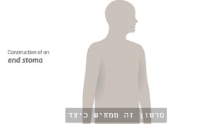 סטומה